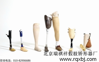 为大腿截肢者选择适合的假肢与矫形器 从评估到适配的完整指南