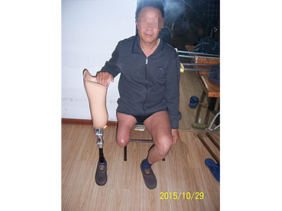 青岛假肢与矫形器服务探析——以青岛市远征假肢矫形器为例