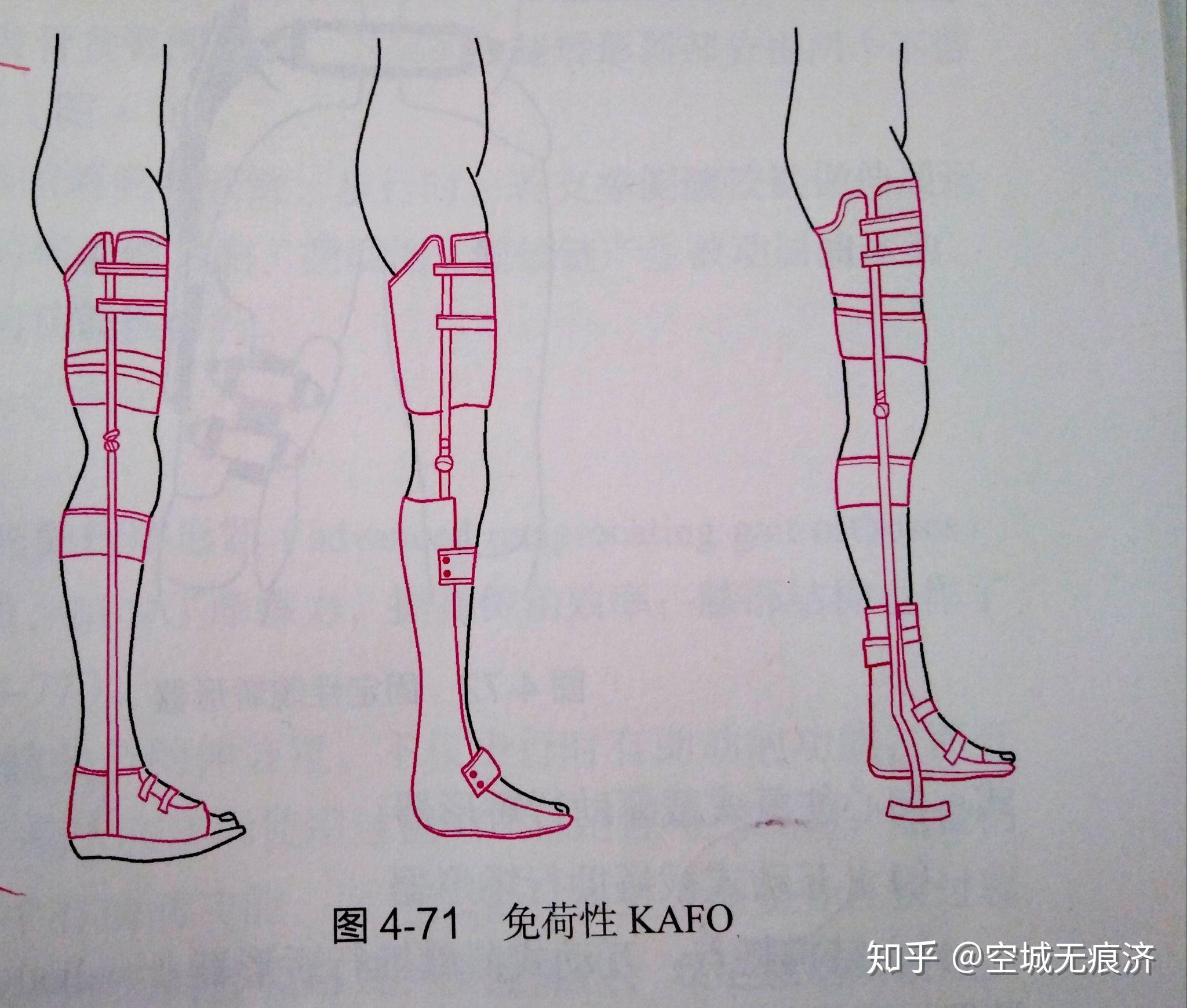 临床康复工程学 假肢与矫形器的功能、设计与发展