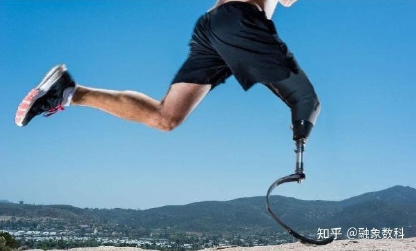 假肢与矫形器制造行业的未来发展趋势